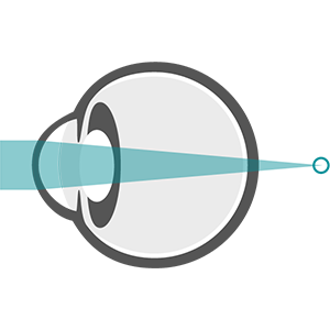 Diagram of the eye showing farsighted vision